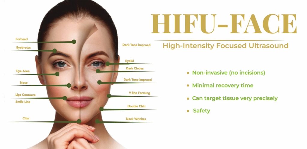 HIFU facial treatment for non-surgical skin tightening